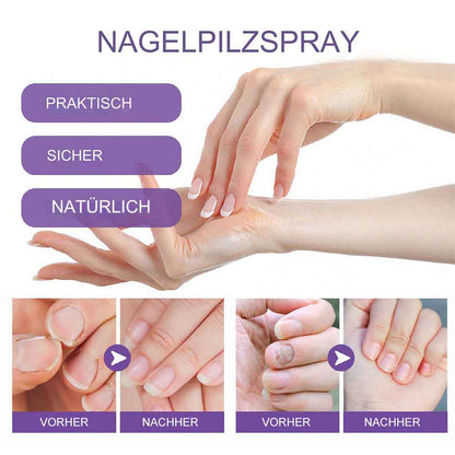 Virales TaiKay™ - Nagel Reparatur Spray